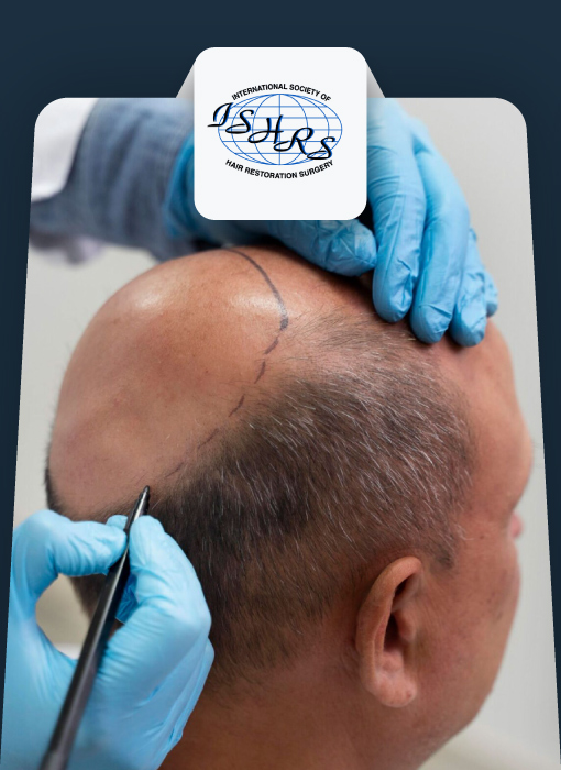 کنگره کاشت مو برلین، ISHRS 33rd Annual Meeting